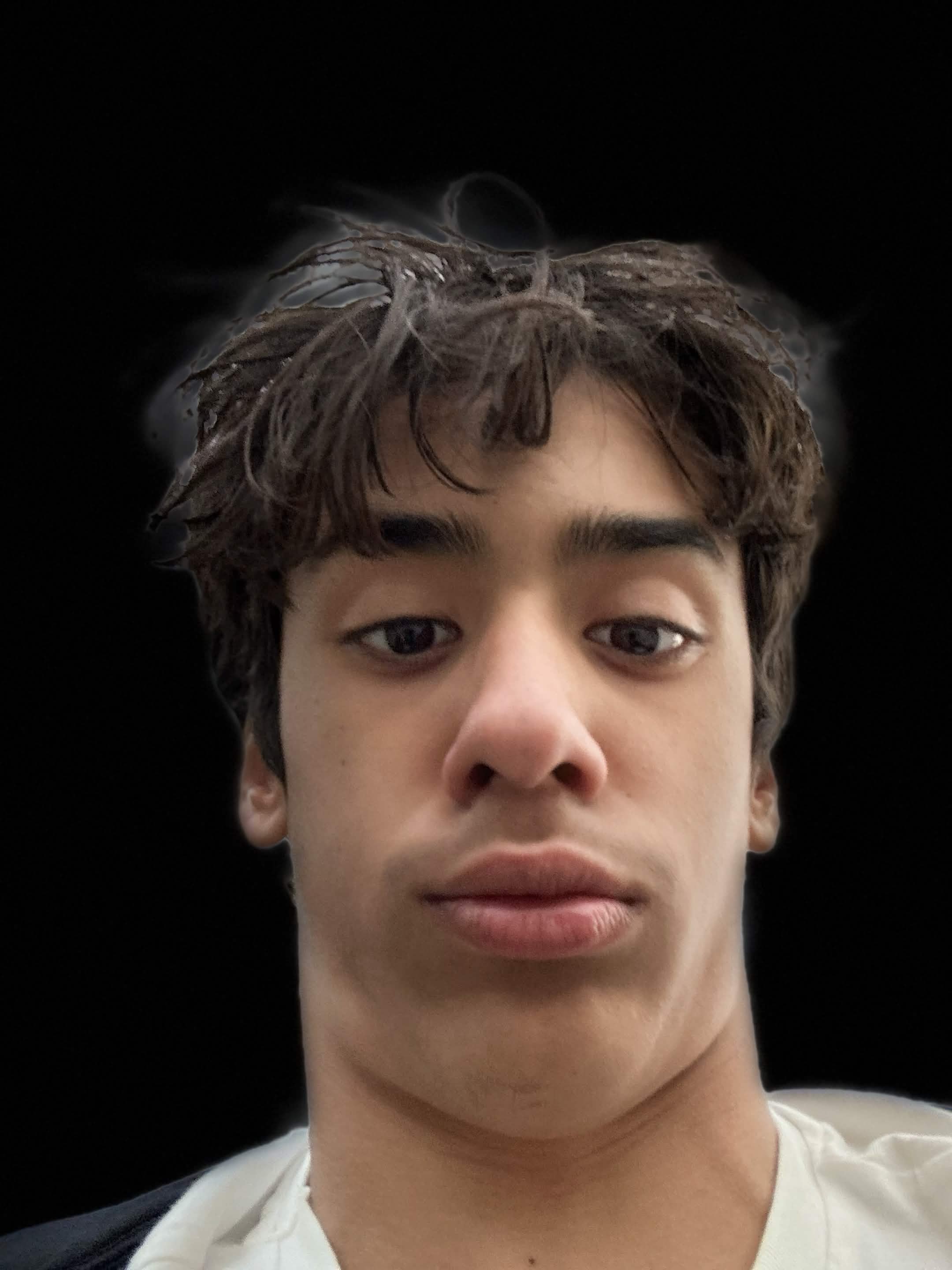 Constipation